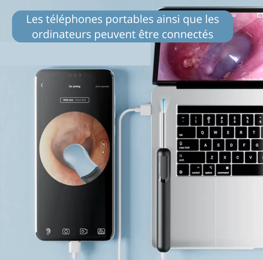 Outil de Retrait de Cérumen - Otoscope Nettoyeur d'Oreilles Connecté avec Caméra Full HD